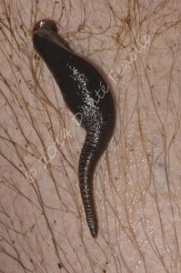 Parasitic leech feeding on human leg, Coñaripe, Los Lagos, Chile, November 2014, No2, LR-M